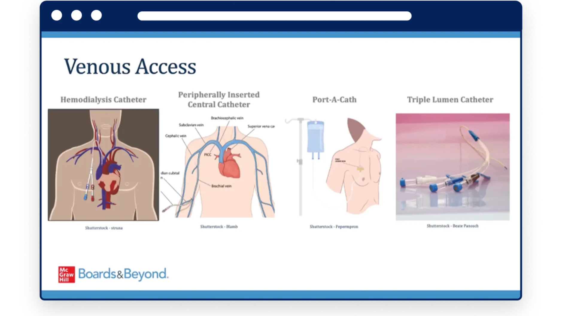 Clinical Confidence sample slide Venous Access