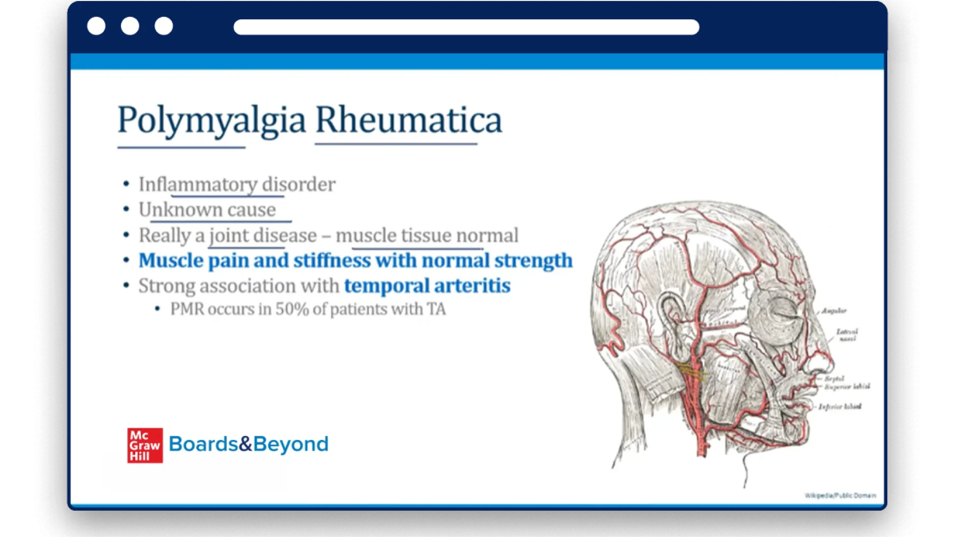 Step 2-3 Sample Slide: Polymyalgia Rheumatica